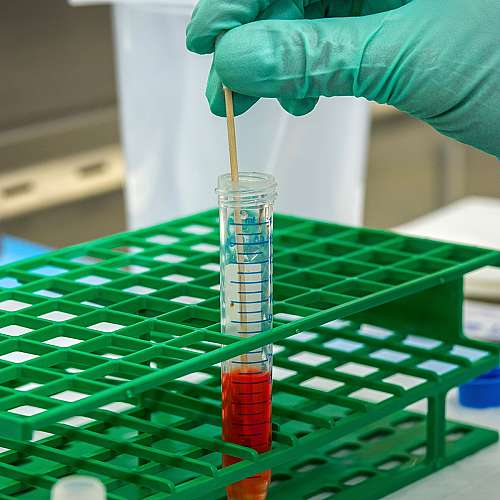 Швейцарски учени разработиха нов кръвен тест за антитела срещу Covid-19